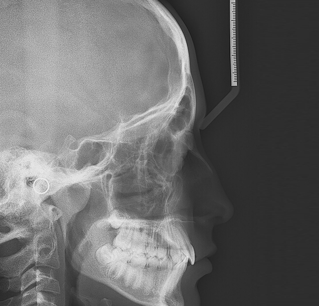 Diagnóstico Digital Odontológico - Centro Medico Cemirt